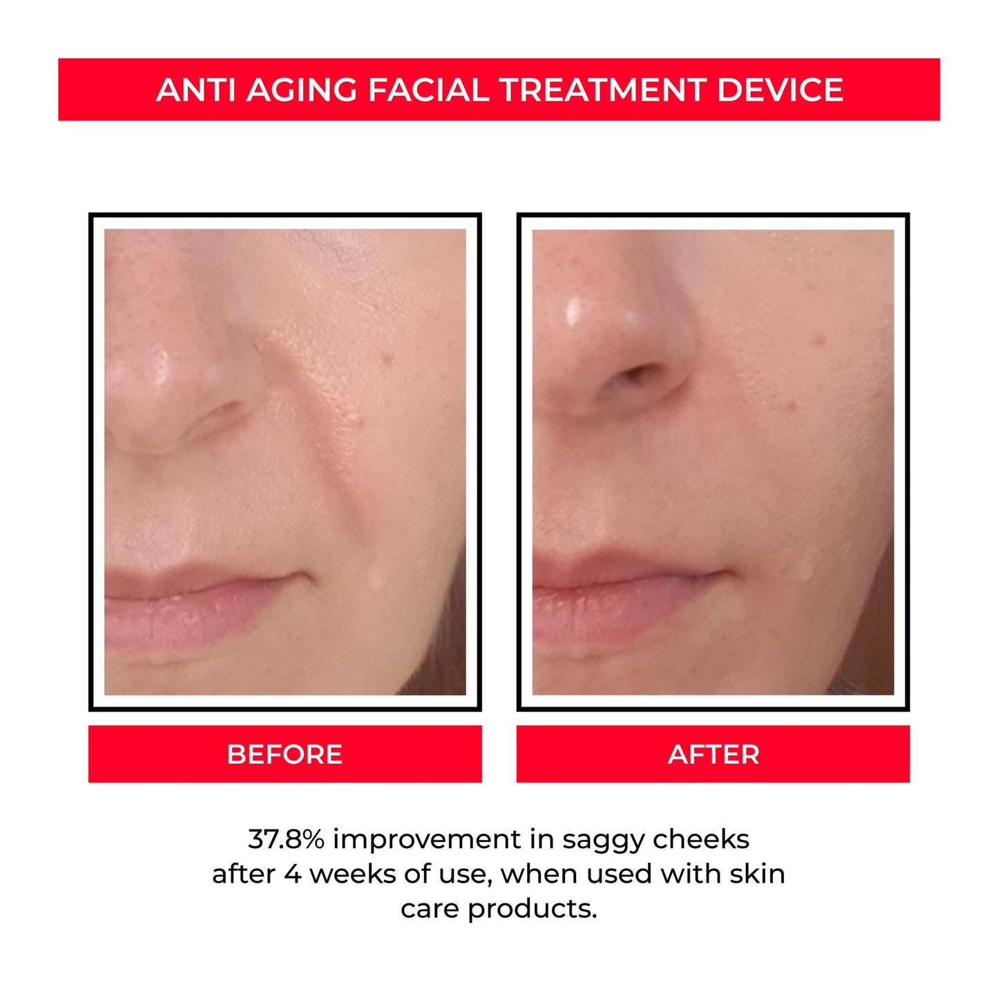 EMS Microcurrent Skin Rejuvenation Device-1