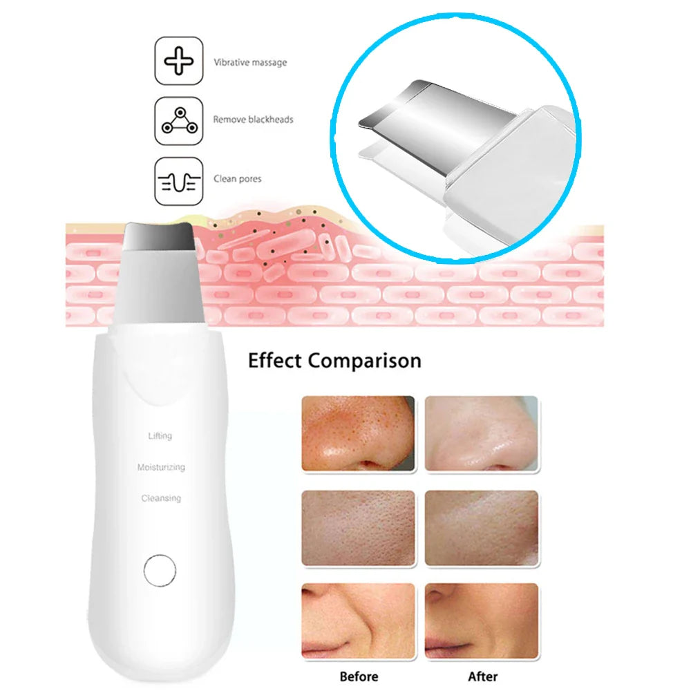 Ultrasonic Skin Scrubber Deep Facial Cleaner-3