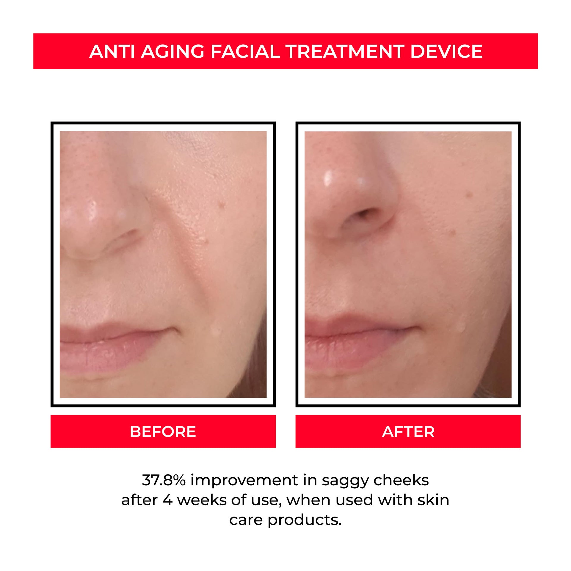 EMS Microcurrent Skin Rejuvenation Device-1