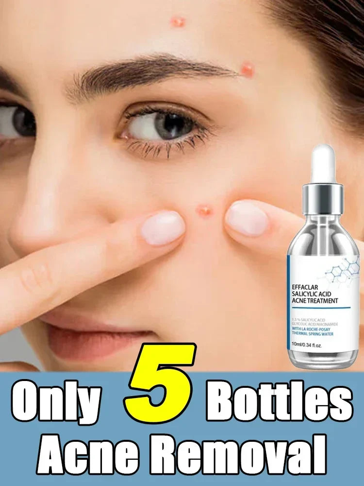 Salicylic Acid Solution Essence-0