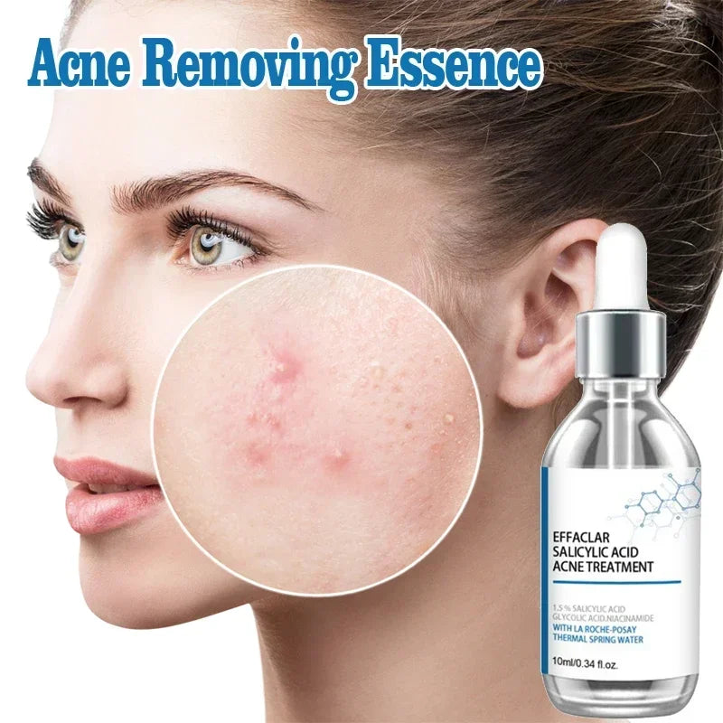 Salicylic Acid Solution Essence-1