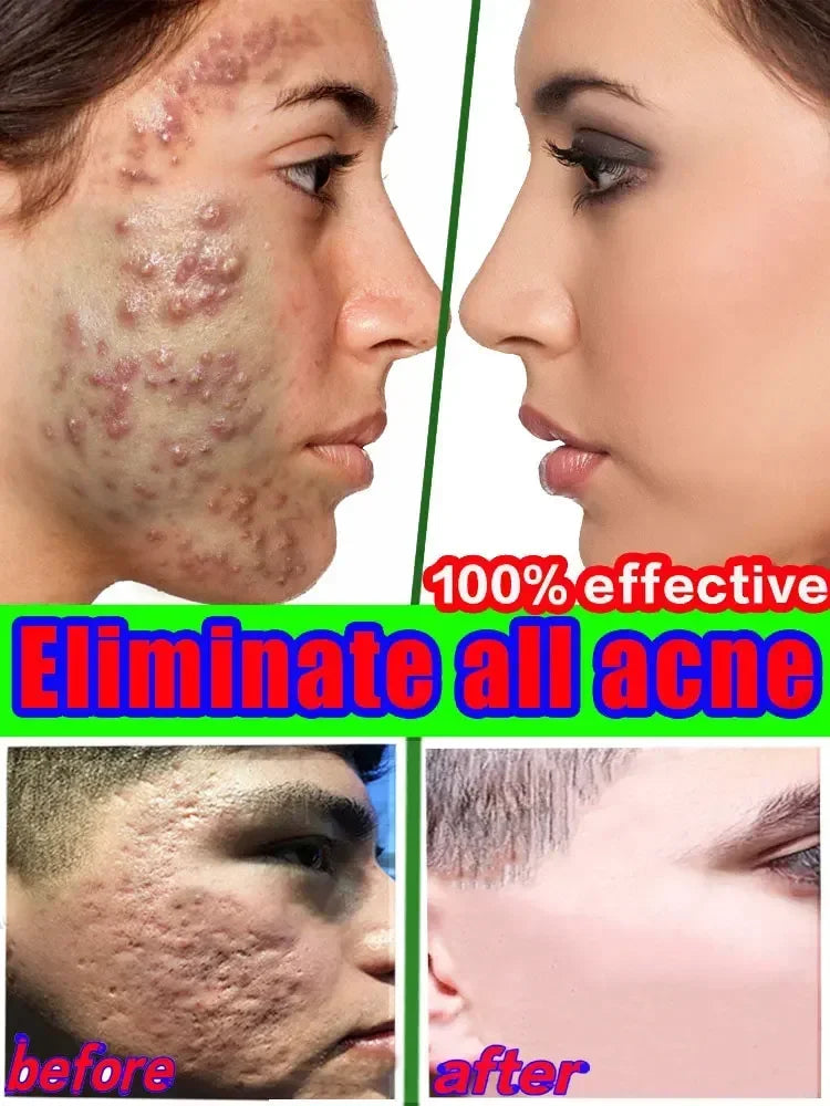 Salicylic Acid Solution Essence-2